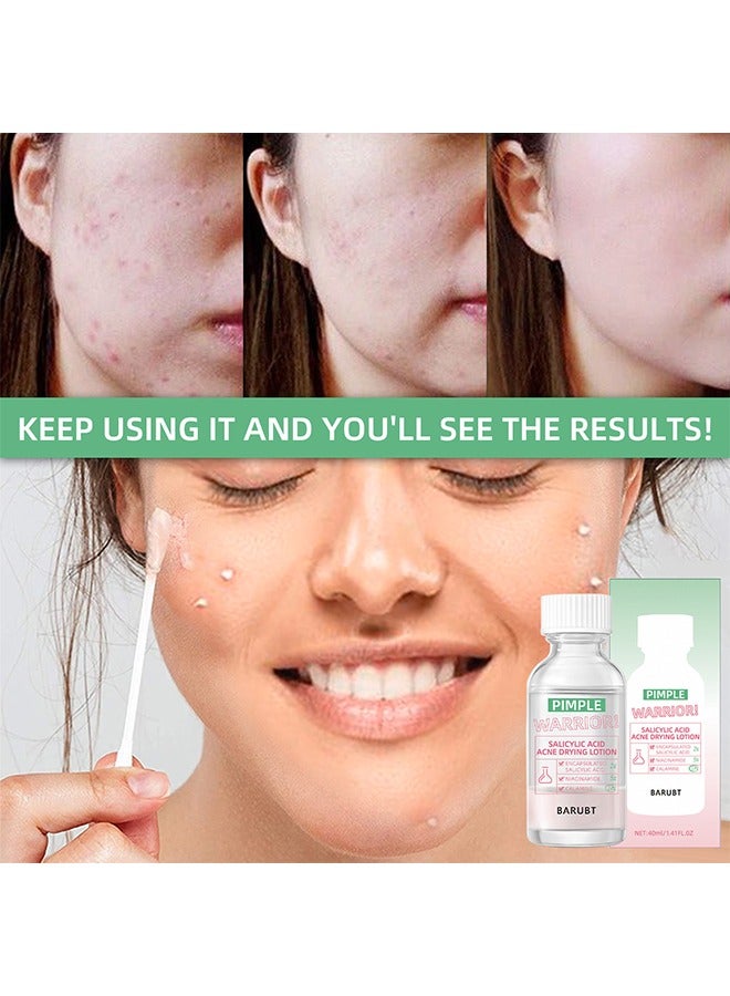 BARUBT Pimple Warrior Salicylic Acid Acne Drying Lotion-Acne Repair,Promotes Acne Removal,For All Skin Types 40ml - Image 2