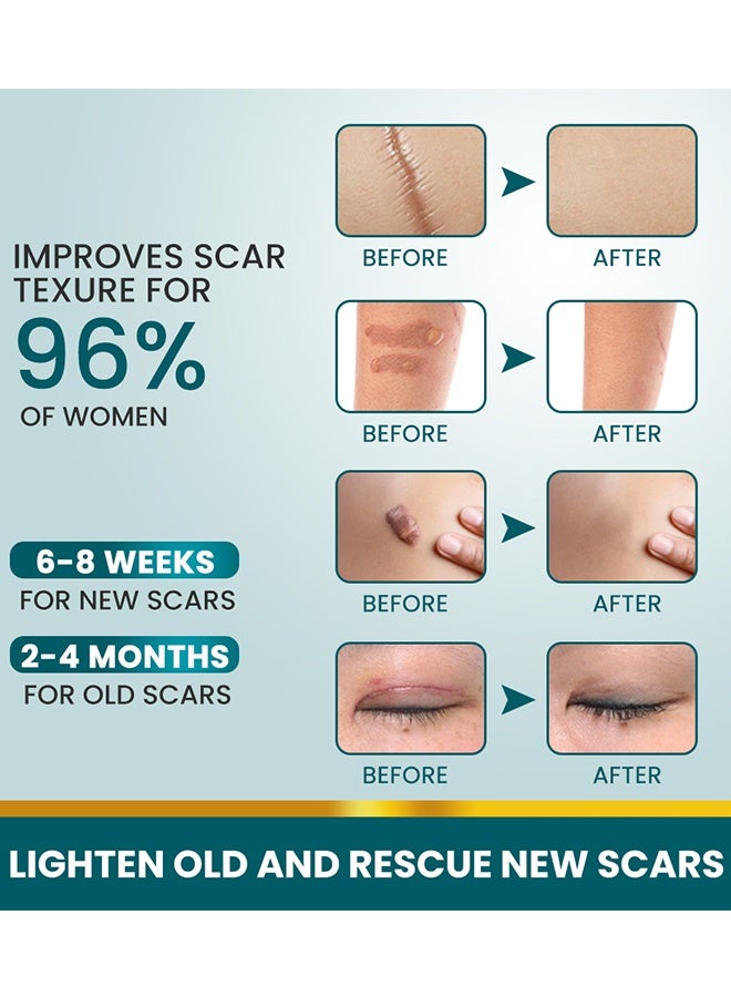 Generic Silicone Scar Sheets (2x 100cm), Silicone Scar Tape for Scar Removal Treatment, Reusable Silicone Scar Strips for C-Section, Keloid, Burn, Acne, Surgical Scars - Image 5