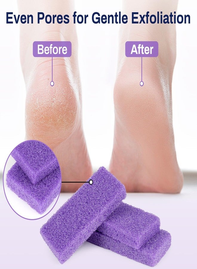 RAQEHO 20 Small Pumice Stone for Feet - 3.6 X 1.8 X 0.47 Inch Purple Foot Pumice Stone Foot Filer Pedicura Scrubber for Callus Removal Foot Care Spa Productos for Dark Elbows Hard Skin Exfoliating - Image 5