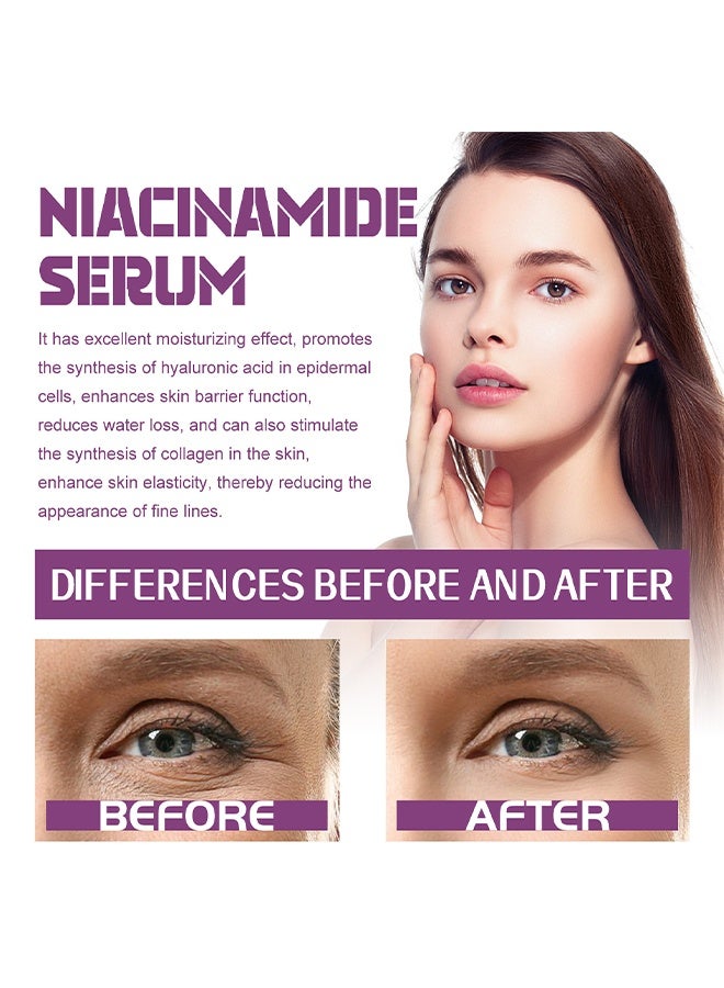 EELHOE Niacinamide 20% Serum，Vitamin B3 Concentrated Serum, 20ml Face Pigment Dark Spot Remover Face Serum, Anti Aging Fragrance Free Face Essence For For Discoloration And Minimizing Large Pores 20ml - Image 3