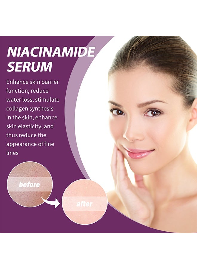 EELHOE Niacinamide 20% Serum，Vitamin B3 Concentrated Serum, 20ml Face Pigment Dark Spot Remover Face Serum, Anti Aging Fragrance Free Face Essence For For Discoloration And Minimizing Large Pores 20ml - Image 2