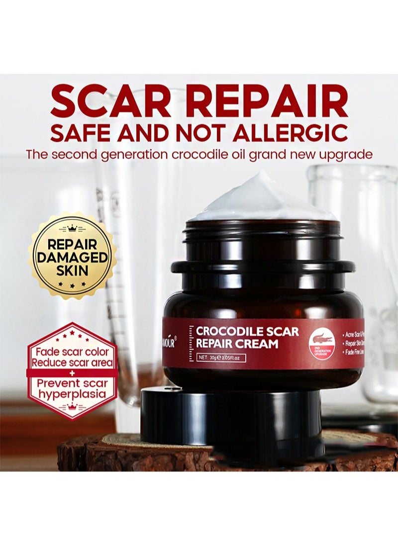 Crocodile Scar Repair Cream，Removal Acne Scar Treatment Stretch Marks Burn Whitening Knife Scar Skin Care（30g）