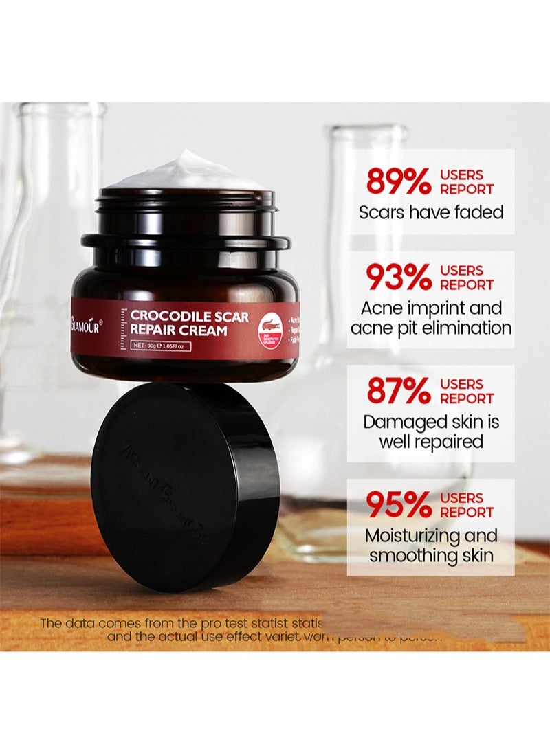 Crocodile Scar Repair Cream，Removal Acne Scar Treatment Stretch Marks Burn Whitening Knife Scar Skin Care（30g）