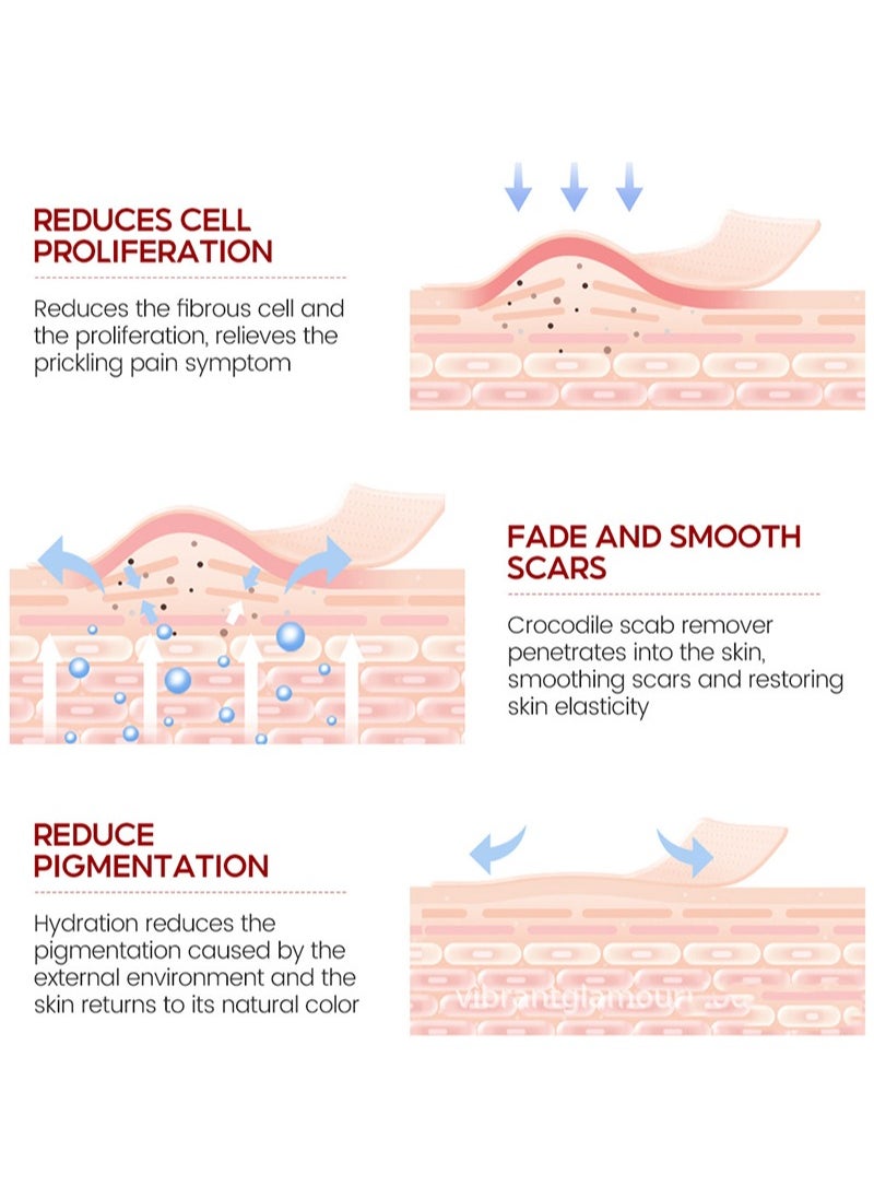 Crocodile Scar Repair Cream，Removal Acne Scar Treatment Stretch Marks Burn Whitening Knife Scar Skin Care（30g）