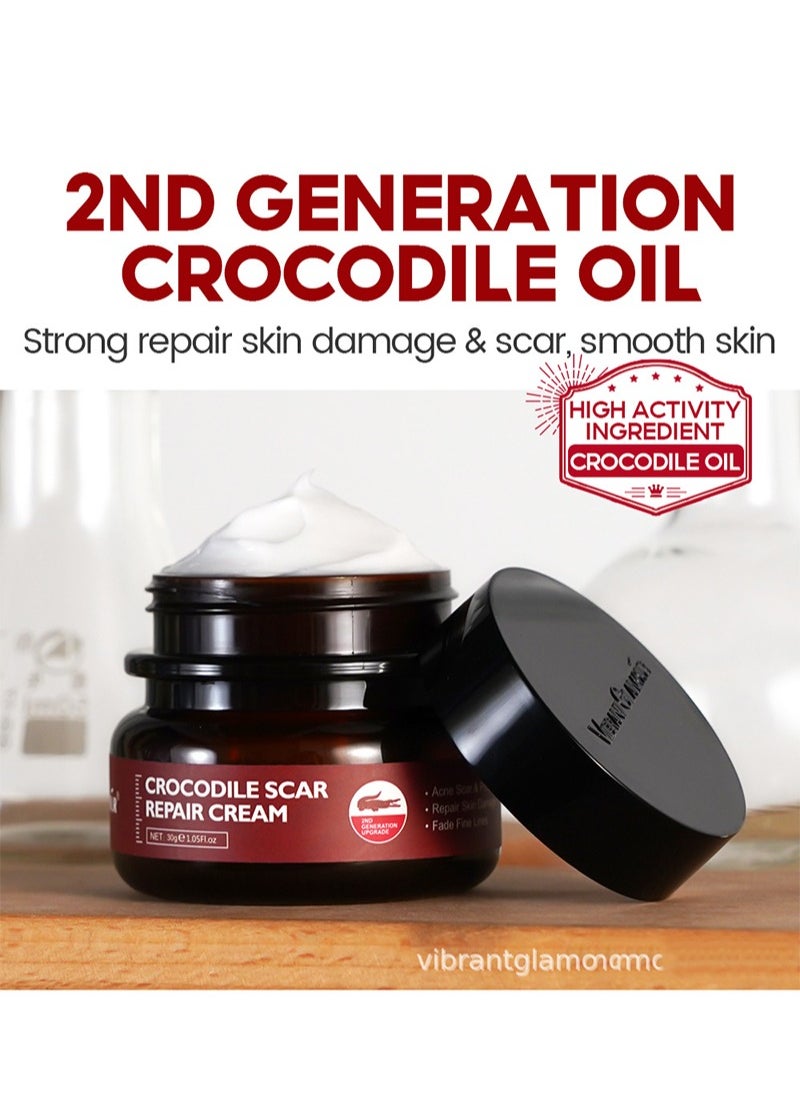 Crocodile Scar Repair Cream，Removal Acne Scar Treatment Stretch Marks Burn Whitening Knife Scar Skin Care（30g）
