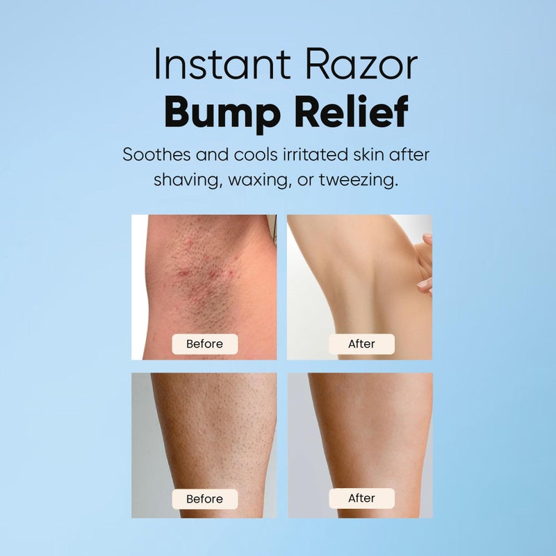 ESTETIST Razor Bump Solution Roll-On, Ingrown Hair & Razor Burn Care Serum, After Shave Roller for Bikini Area, Face, Neck, Underarm & Legs, Skin-Soothing Post Shave Care - Image 3