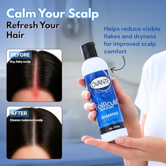 Ovante Folliculiti Shampoo for Men & Women with Scalp Folliculitis, Greasy Hair, Itchy & Flaky Scalp, Extra Strength Folliculitis Treatment Shampoo - 7 fl. oz. - Image 3