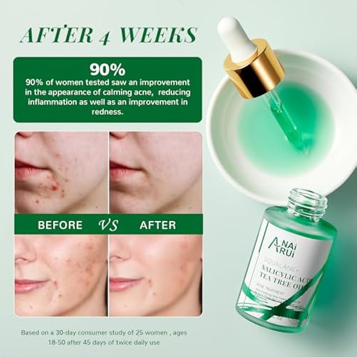 ANAI RUI Acne Face Oil,Tea Tree Oil with Salicylic Acid,Acne Prone Skin Oil,Soothe Acne,Redness Relief, Tea Tree Oil for Face,Back, Clarifying & Purifying 1Fl.OZ - Image 5