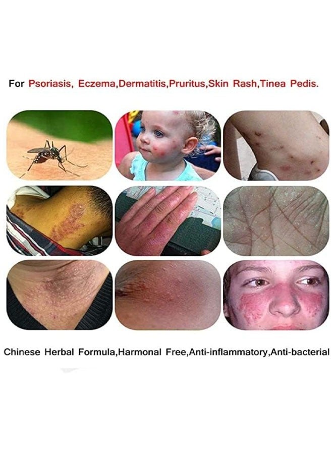 زودايفو كريم مضاد للبكتيريا العناية بالبشرة كريم عشبي صيني كريم مضاد للبكتيريا غني بمستخلص الأعشاب جوهر المنتج الإغاثة من الوخز كريمات الإكزيما التهاب الجلد مرهم الصدفف الجلد - Image 4