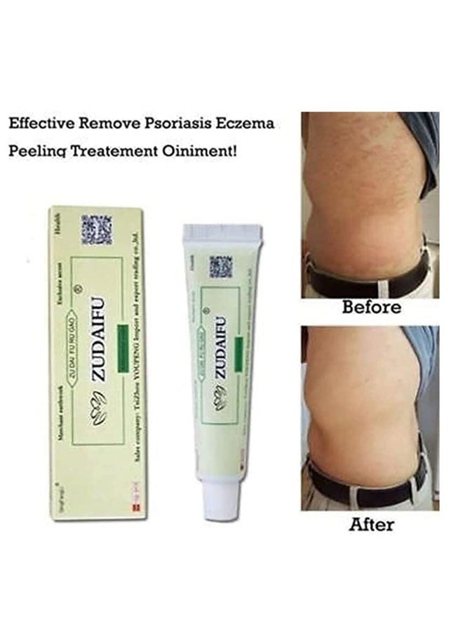 زودايفو كريم مضاد للبكتيريا العناية بالبشرة كريم عشبي صيني كريم مضاد للبكتيريا غني بمستخلص الأعشاب جوهر المنتج الإغاثة من الوخز كريمات الإكزيما التهاب الجلد مرهم الصدفف الجلد - Image 5