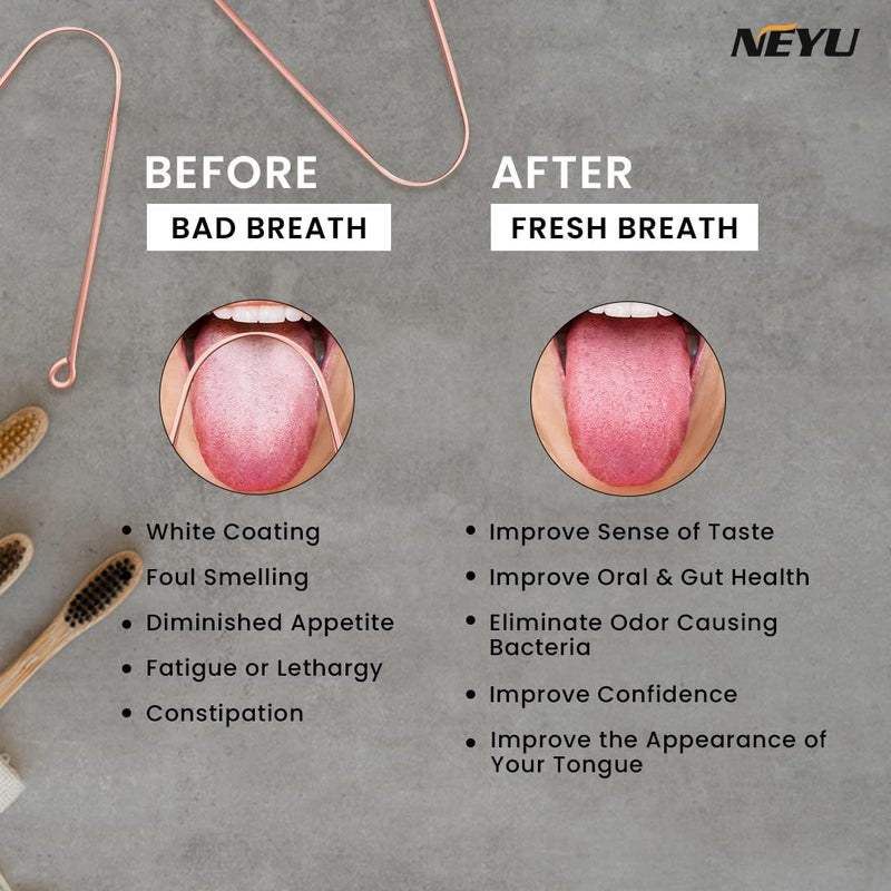 NEYU Surgical Grade Copper Tongue Cleaner Scraper | Bacteria Inhibiting | An Anti-Microbial Tongue Cleaner | Ayurvedic Tongue Scraper For Adults And Kids (2 Piece) - Image 5