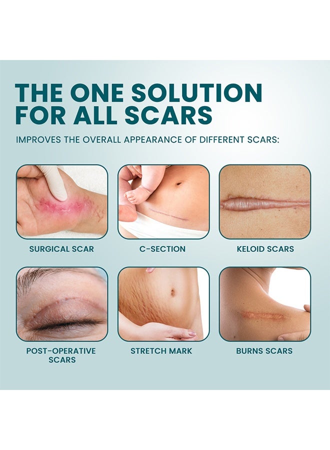 Sumifun Silicone Scar Cream, Skin Scar Cream，Body Scar Removal, Scar Cream，Scar Gel，Acne Scar Treatment，Deep Acne Scar Removal， Burns Keloids Hypertrophic， Scar Removal Cream， Repair Damaged Skin，Removing Acne Marks, Scar Repair Cream - Image 2