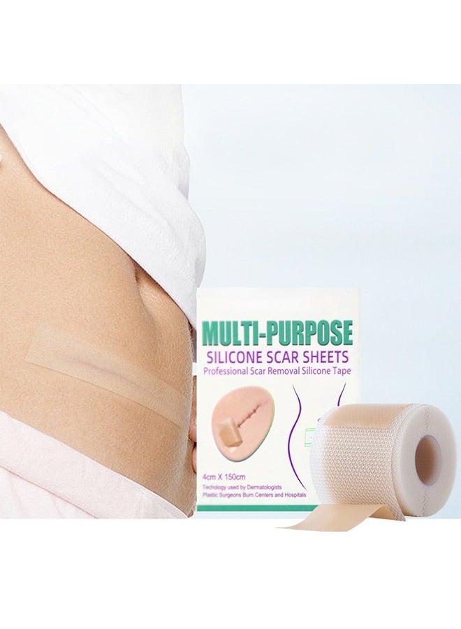 Generic Silicone Scar Patch, Fade Scar Sticker, Efficient Beauty Scars Removal Cesarean Section Burn Scars Left Behind Gel Painless Tape Roll (4cm * 1.5m)  - Image 1