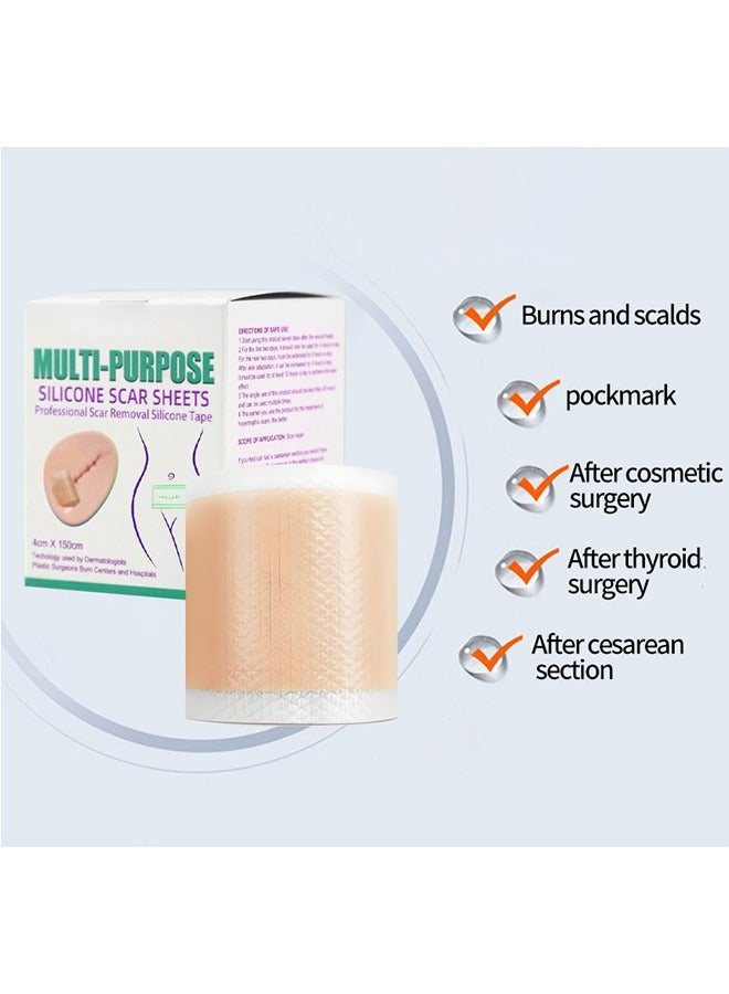 Generic Silicone Scar Patch, Fade Scar Sticker, Efficient Beauty Scars Removal Cesarean Section Burn Scars Left Behind Gel Painless Tape Roll (4cm * 1.5m)  - Image 2