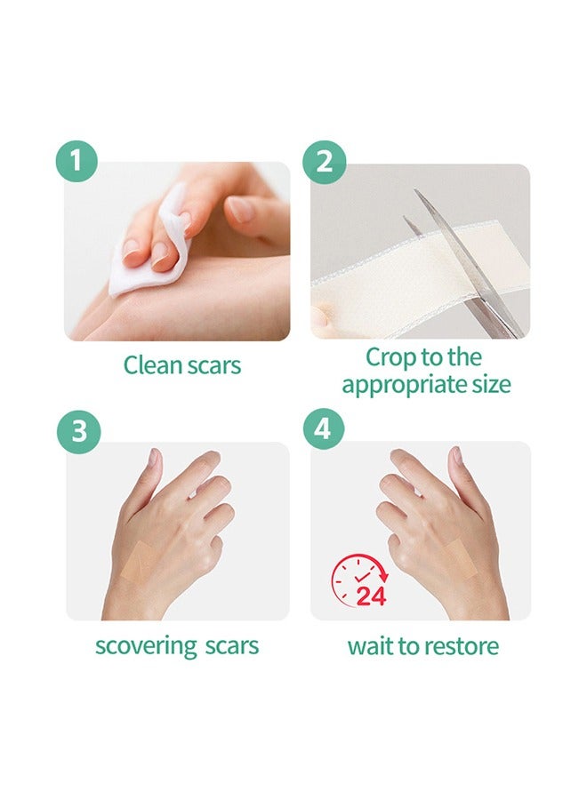Generic Silicone Scar Patch, Fade Scar Sticker, Efficient Beauty Scars Removal Cesarean Section Burn Scars Left Behind Gel Painless Tape Roll (4cm * 1.5m)  - Image 3