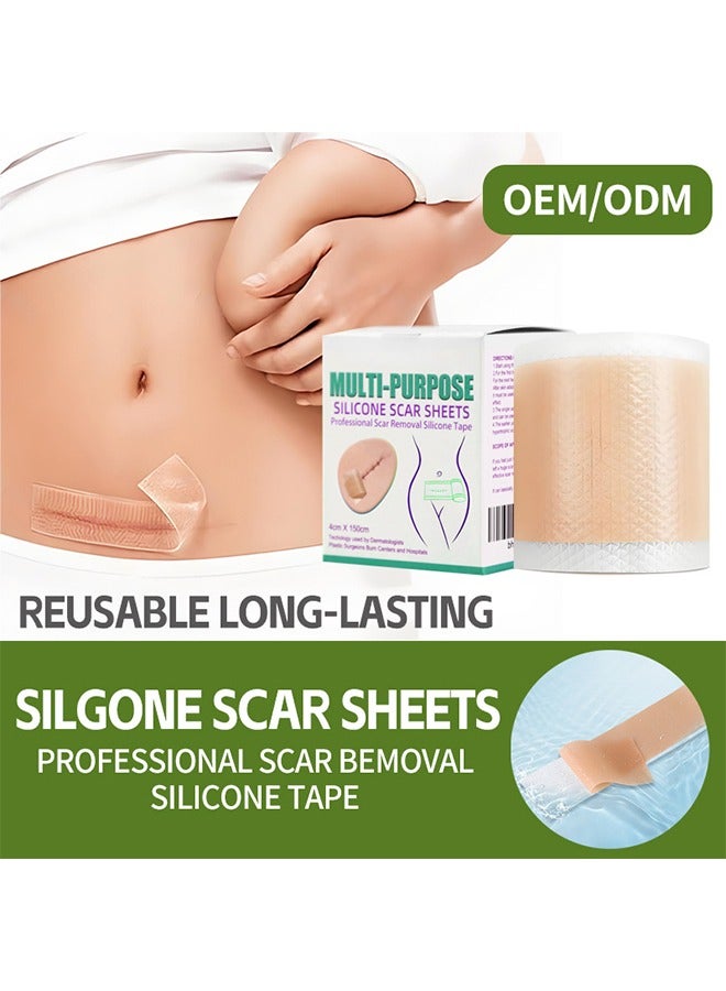 Generic Silicone Scar Patch, Fade Scar Sticker, Efficient Beauty Scars Removal Cesarean Section Burn Scars Left Behind Gel Painless Tape Roll (4cm * 1.5m)  - Image 4