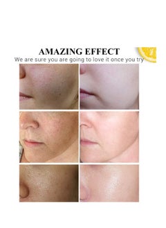 ديسار سيروم الوجه بحمض الهيالورونيك وفيتامين سي 30 مل  - Image 5