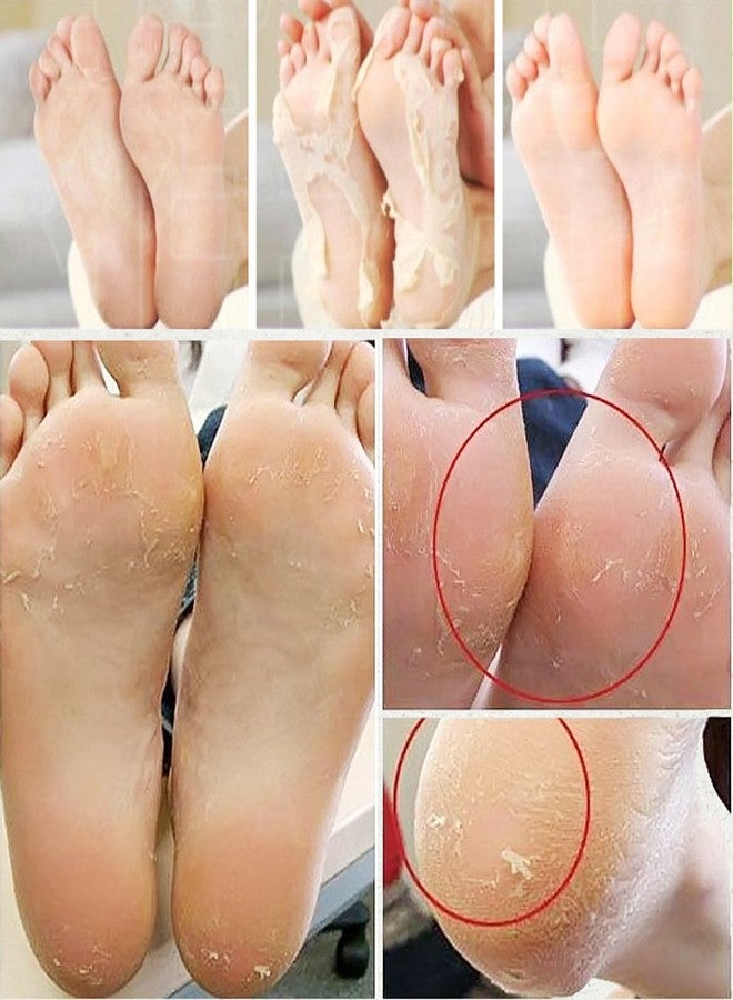 SJ 2 in 1 Callous Corn Cuticle Cutter Remover Manicure Pedicure Nail Foot Care - 03 A - Image 3