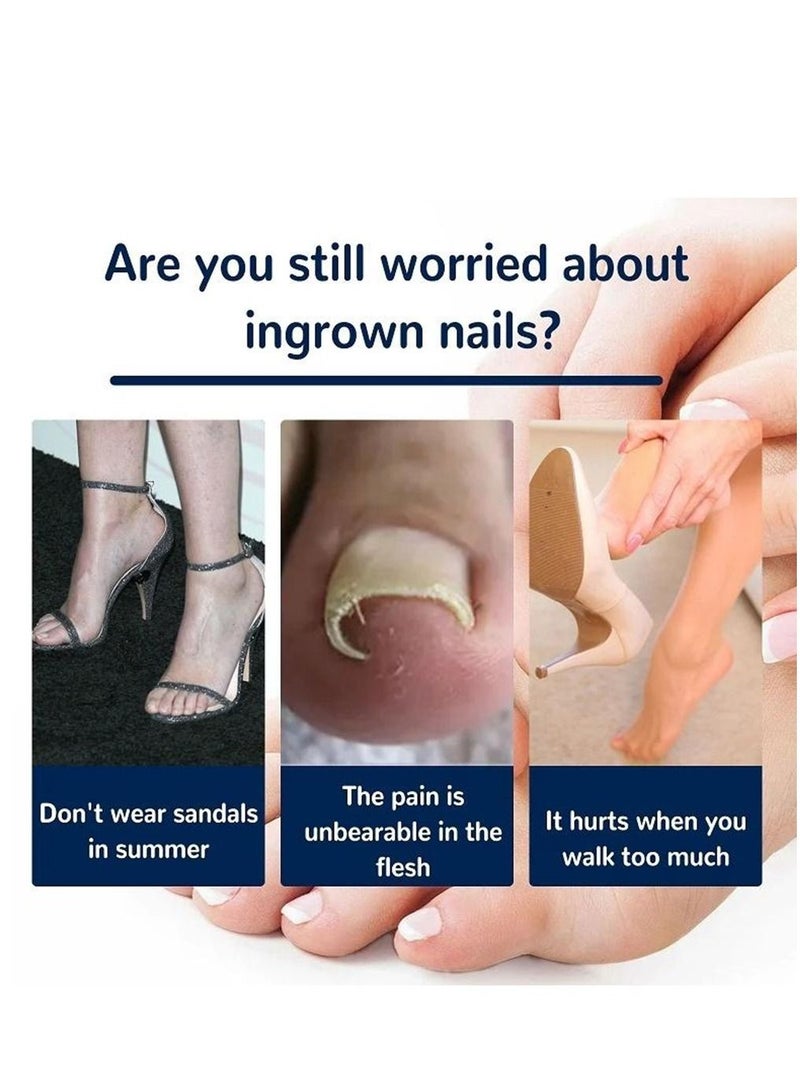 EELHOE 100 Pieces  Ingrown Toenail Correction Stickers Toenail Corrector Patch Glue free Ingrown Toenail Corrector Strips Toe Nail Correction File Patches Relieve Nail Groove Unisex - Image 3