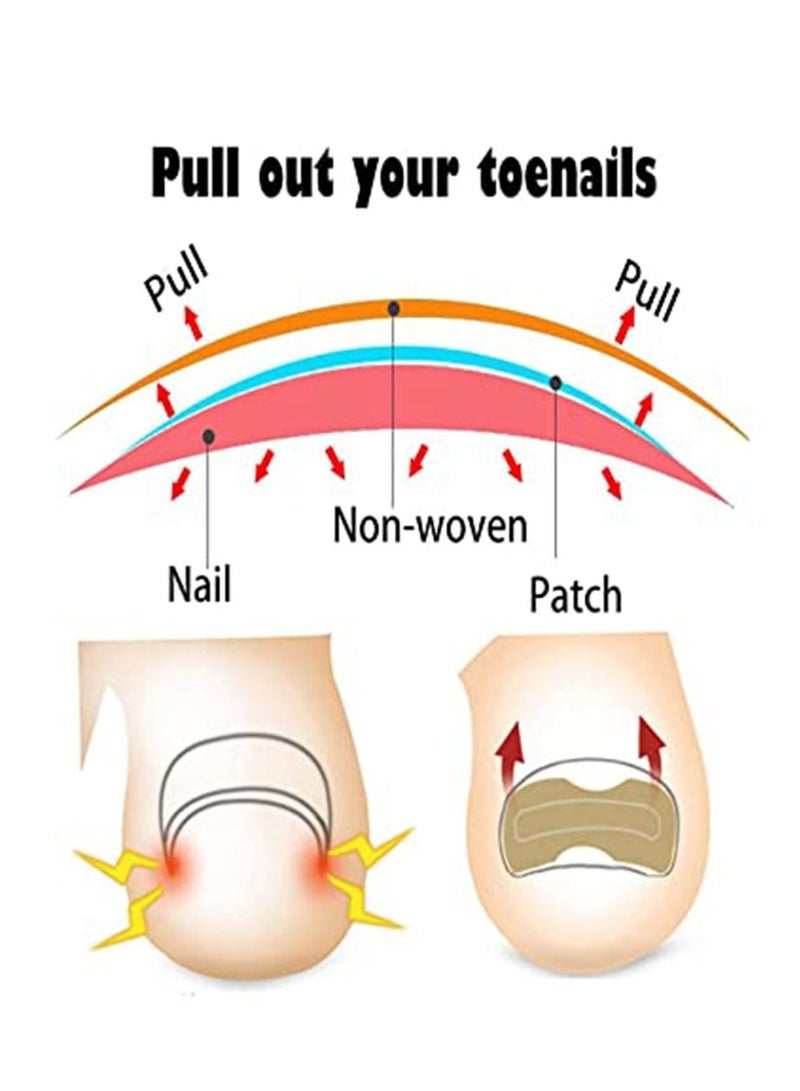 EELHOE 100 Pieces  Ingrown Toenail Correction Stickers Toenail Corrector Patch Glue free Ingrown Toenail Corrector Strips Toe Nail Correction File Patches Relieve Nail Groove Unisex - Image 5