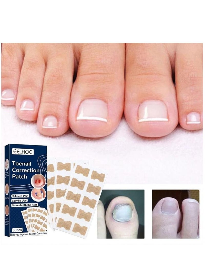 EELHOE 100 Pieces  Ingrown Toenail Correction Stickers Toenail Corrector Patch Glue free Ingrown Toenail Corrector Strips Toe Nail Correction File Patches Relieve Nail Groove Unisex - Image 2