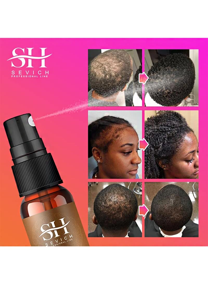 Sevich Naturals Chebe Hair Growth Spray，100% African Chebe Essence，Thin Loss Hair Treatment， Moisture&Repair Damaged Hair Root，Scalp Skin Refresh 30ml - Image 5