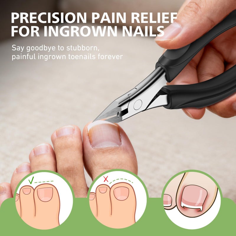 BALUCA Professional Straight Edge Toenail Clippers for Thick Nails & Ingrown Toenails - Heavy Duty Long Handle Nail Clippers for Seniors and Adults with Precision Design for Pain-Free Grooming,Black - Image 2