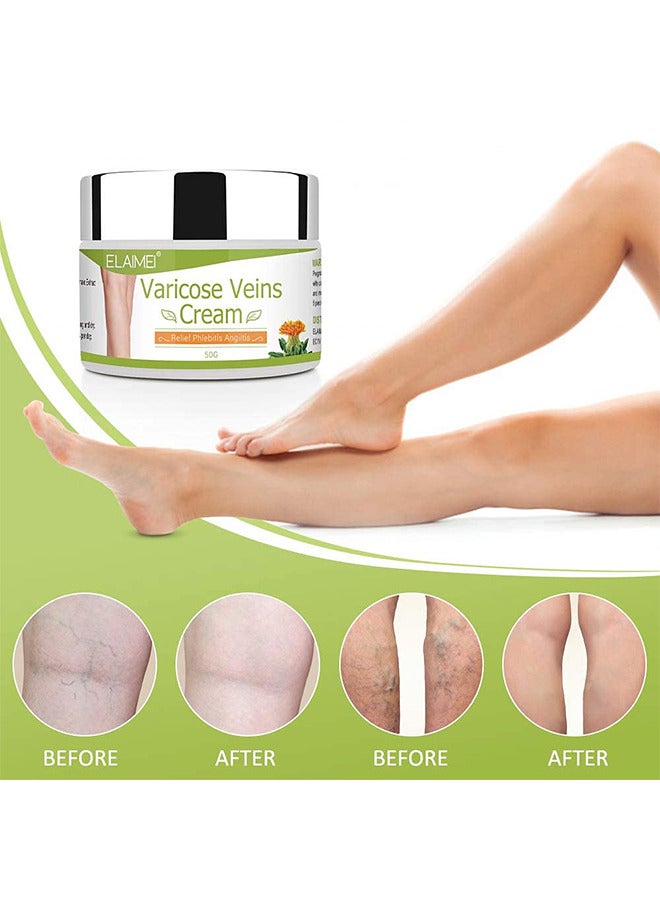 Elaimei Varicose Veins Cream, Varicose Vein Soothing Leg Cream, Relief Phlebitis Vein Treatment Legs Spider Veins Improves The Appearance Of Leg Relieves Varicose Vein Discomfort Pain Strain - Image 5