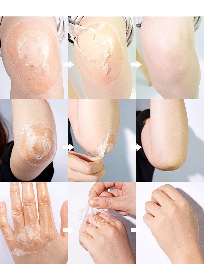Vitamin C Peeling Lotion 100G, Effectively Soften The Keratin, Improve Rough Epidermis Delay Skin Aging And Make The Skin Soft And Elastic, Whiten And Smooth