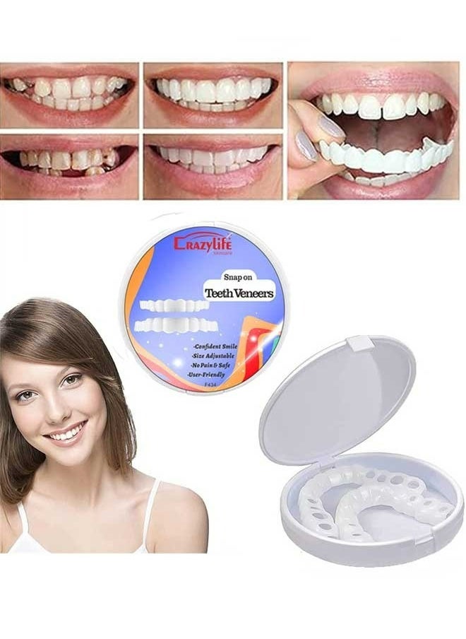 Crazylife Teeth Veneers, Denture Occlusal Veneer For Upper And Lower Jaw Dentures, No Pain No Shot No Drilling, Natural And Comfortable, Protecting Teeth, Restoring Confidence Smiling  - Image 1