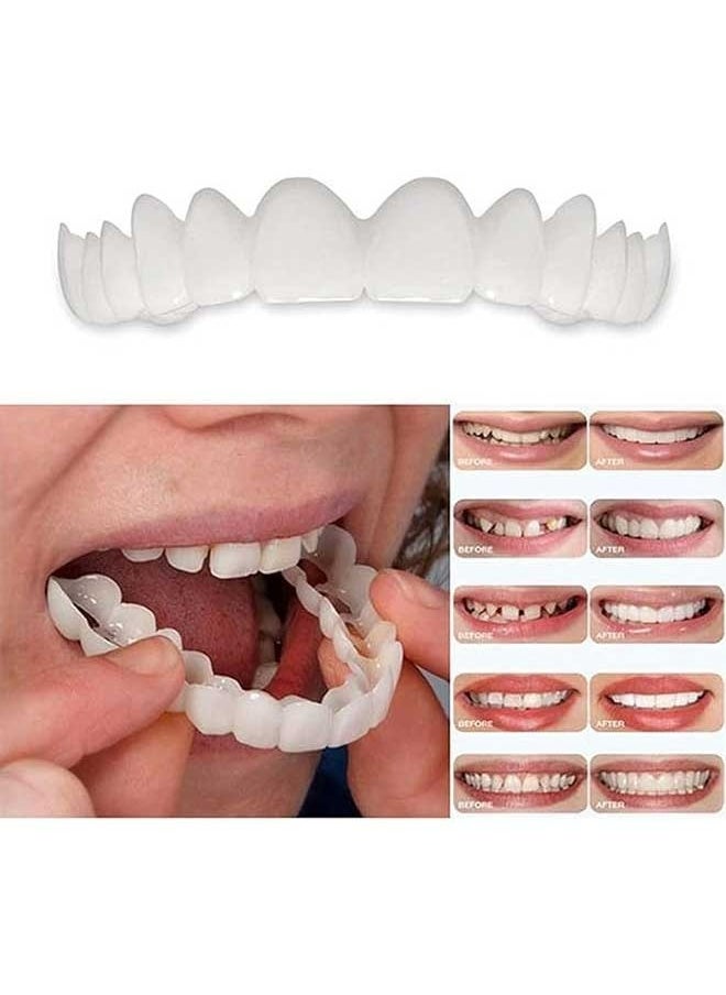 Crazylife Teeth Veneers, Denture Occlusal Veneer For Upper And Lower Jaw Dentures, No Pain No Shot No Drilling, Natural And Comfortable, Protecting Teeth, Restoring Confidence Smiling  - Image 3