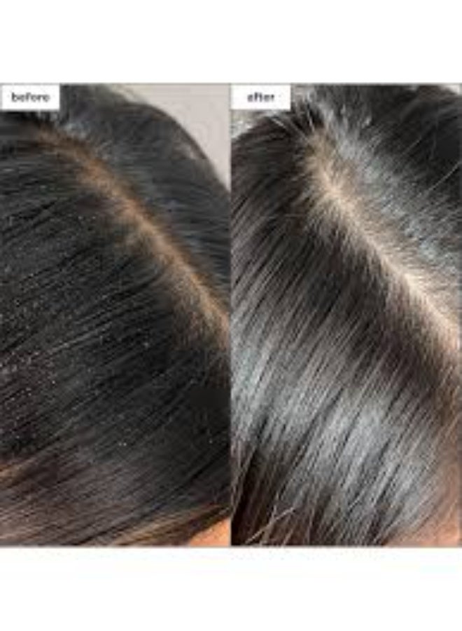 بريوجيو بخاخ بريوجيو سكالب ريفايفل™ لإزالة السموم المتراكمة بالفحم وشجرة الشاي 120 مل - Image 2