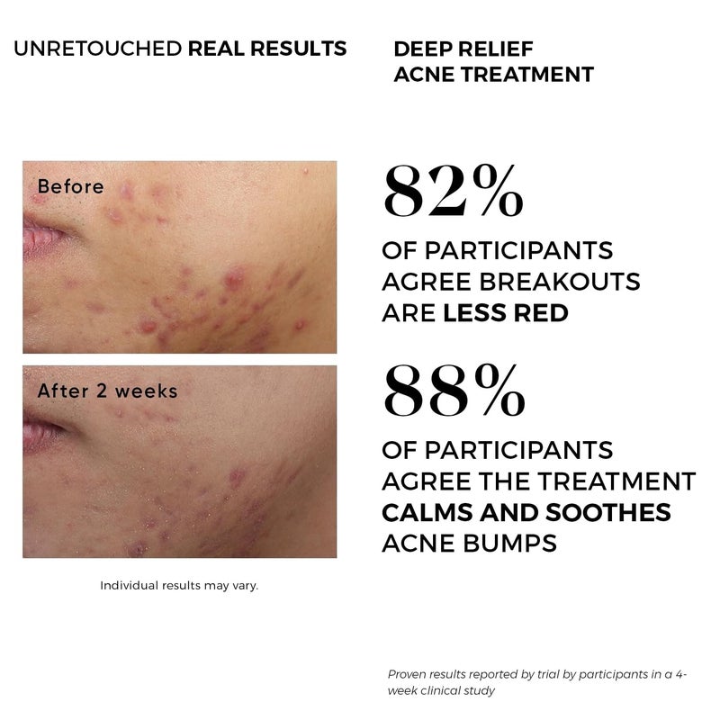 Dermlogic Acne Treatment Pads-Contains Glycolic, Lactic, Salicylic Acid. Eliminates Oily Skin, Clogged Pores & Cystic Breakouts. Removes Dark Spots, Whitehead & Blackhead Pimples for Face & Body. - Image 5