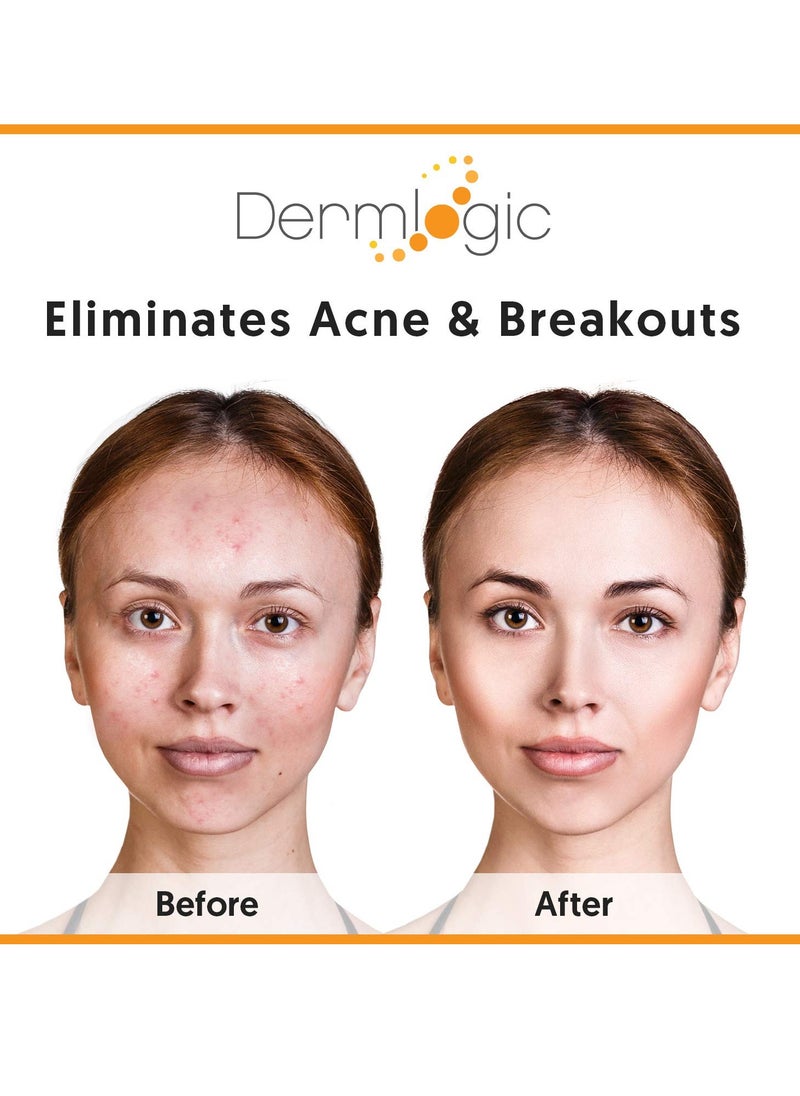 Dermlogic Acne Treatment Pads-Contains Glycolic, Lactic, Salicylic Acid. Eliminates Oily Skin, Clogged Pores & Cystic Breakouts. Removes Dark Spots, Whitehead & Blackhead Pimples for Face & Body.  - Image 3