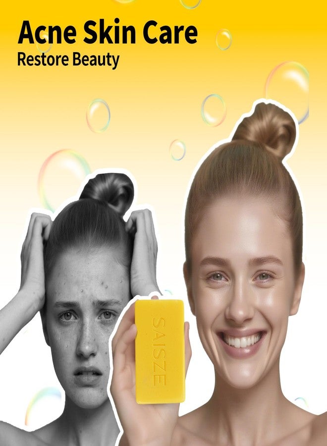 SAISZE Natural Sulfur Soap for Acne and Blackheads, Sulfur Face Wash Bar Keeps Pores Cleaner, Organic Sulphur Soap Bar Helps Oily Skin and Blemishes, 4 Ounce (Pack of 2) - Image 2