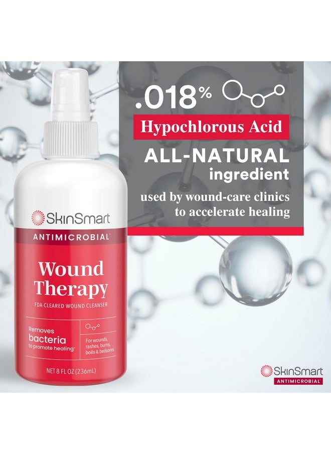 Wound Therapy, Hypochlorous Acid Safely Removes Bacteria So Wounds Can Heal, 8 Ounce Clear Spray - pzsku/Z6B9B79904D2650189FB1Z/45/_/1735214344/847d84c2-8792-4ea1-9b96-2fd515a1511b