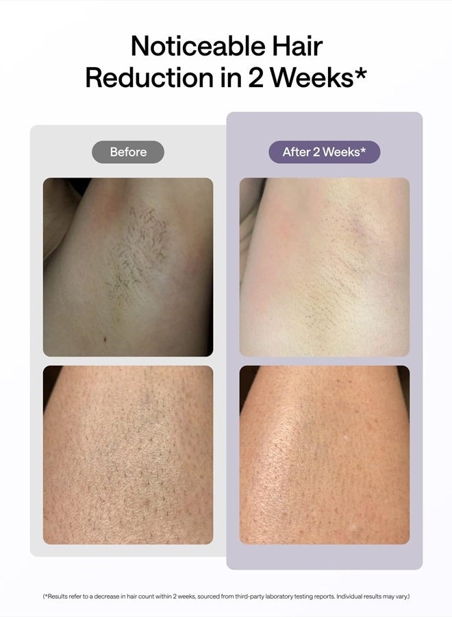 Ulike Laser Hair Removal, Air 10 IPL Hair Removal for Women and Men, 65°F Ice-Cooling Contact, Dual Lights, Skin Sensor & SHR Mode* for Nearly Painless, Effective & Long-Lasting Hair Removal from Home - Image 3