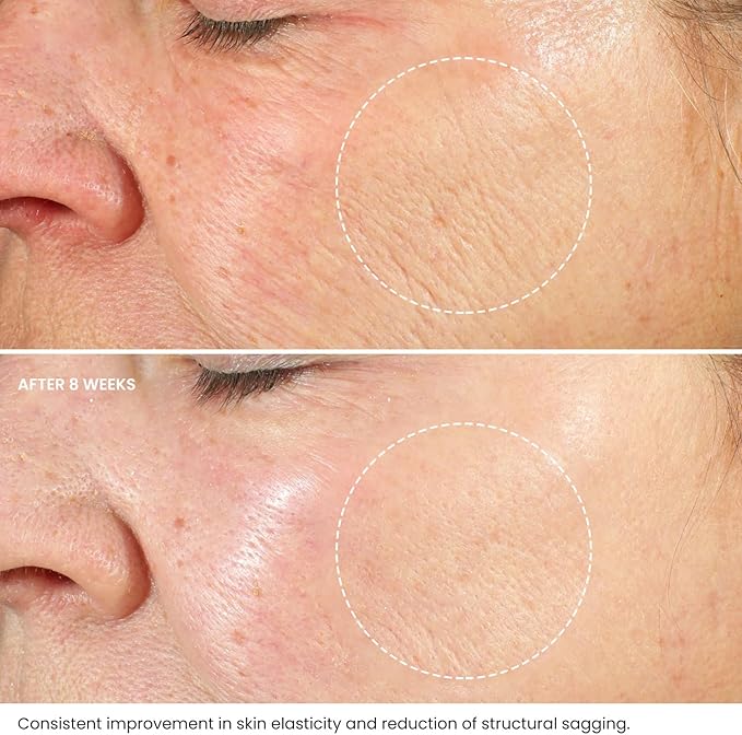 Kleem Organics Retinol Face Cream with Hyaluronic Acid Vitamin E AntiWrinkle Firming Night Cream Hydrating Night Moisturiser to Reduce Lines and Wrinkles For Sensitive Skin 50ml - Image 2