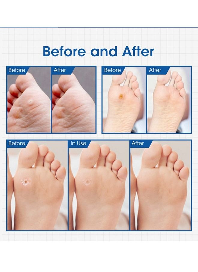 MQ - 24 Pcs Foot Corn Removal Plaster,Natural Ingredients,Foot Care Expert,Calluses Plantar Treatment,Relief Pain From Calluses, Corns, Blisters, Heel Frictions - Image 1