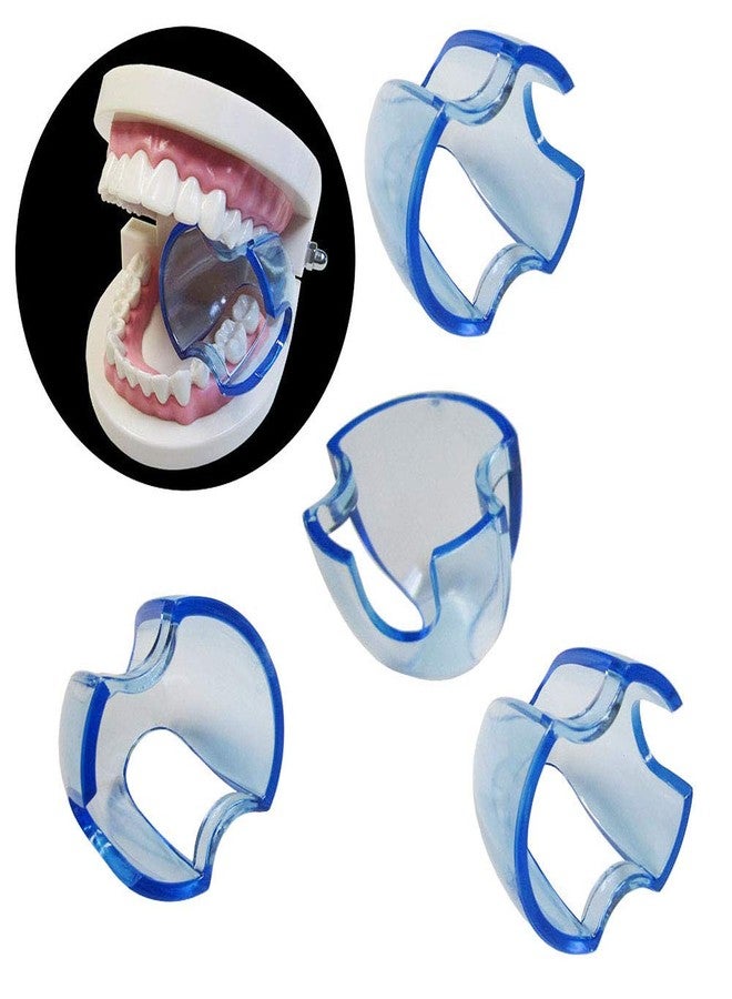 Smiledt Dental Orthodontic Lip Cheek Retractor Expander Mouth Opener Autoclavable for Posterior Teeth (15 Pieces/lot) - Image 5