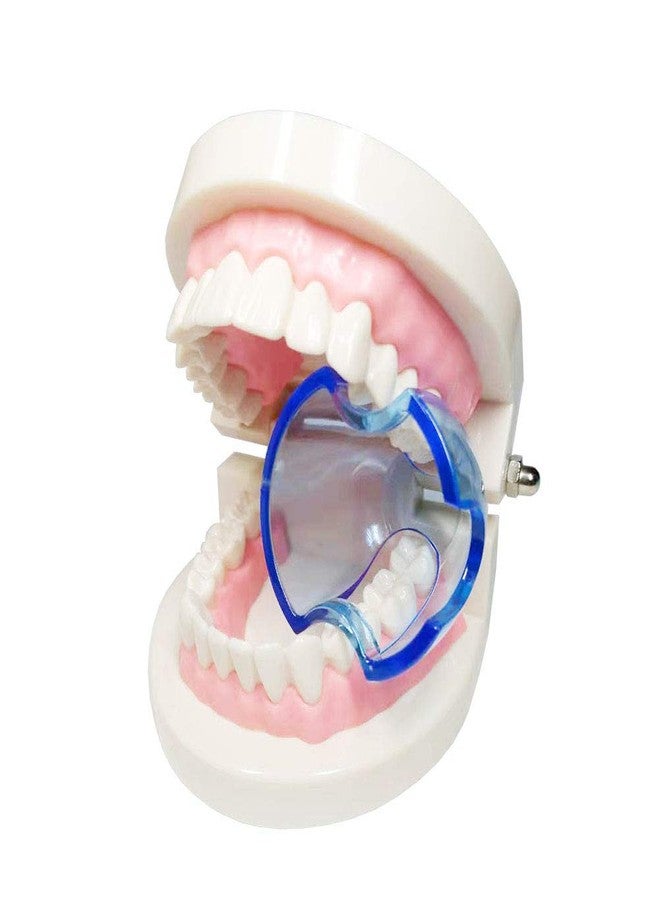 Smiledt Dental Orthodontic Lip Cheek Retractor Expander Mouth Opener Autoclavable for Posterior Teeth (15 Pieces/lot) - Image 3