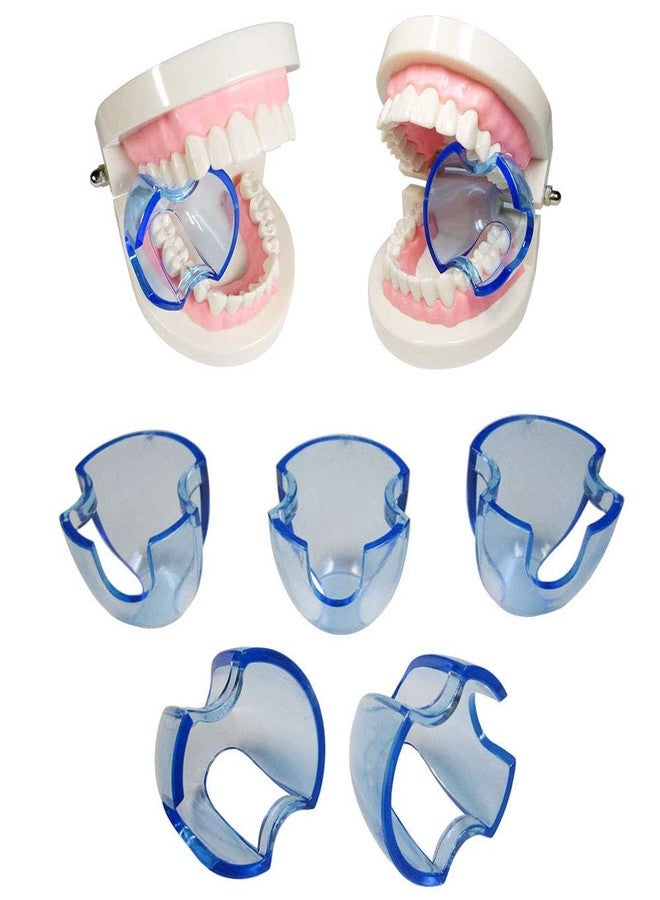 Smiledt Dental Orthodontic Lip Cheek Retractor Expander Mouth Opener Autoclavable for Posterior Teeth (15 Pieces/lot) - Image 1