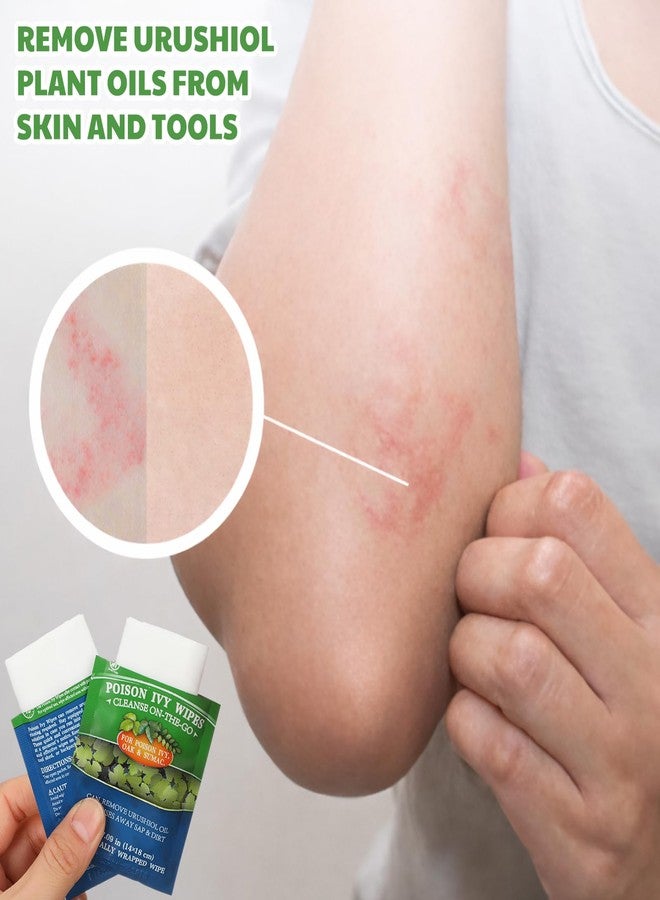 Swiffen 100 Pack Pre and Post Contact Poison Plant Ivy Wipes Individually Packaged Ivy Oak Treatment Wet Wipe for Poison Plant Insect Bite Relief Oak Sumac Treatment Anti-Itch - Image 5