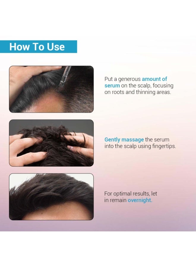 So True Sotrue Hair Growth Serum With 3% Redensyl - 2x Better Results than Minoxidil | 3% Procapil, 4% Anagain & 2% Baicapil | Hair Growth Actives, Hair Fall Control Serum For Women & Men, For All Hair Types, 30ml - Image 3