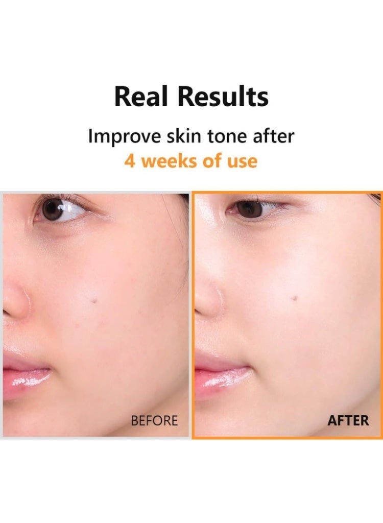 ISNTREE Hyper Vitamin C 23 Serum 20ml – Korean 23% Pure Ascorbic Acid Brightening Serum for Hyperpigmentation, Dark Spots, Even Skin Tone & Anti-Aging - Image 4
