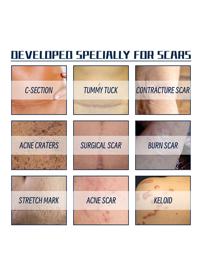 West&Month High-Grade Formula Scar Gel, Silicone Scar Removal Gel, Hight Quality Scar Removal Gel, Acne Scar Treatment, Deep Acne Scar Removal, Burns Keloids Hypertrophic, Repair Damaged Skin, Removing Acne Marks Scar Repair Cream 20g - Image 3