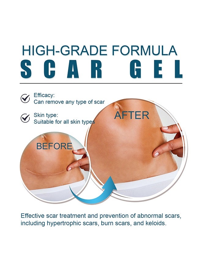 West&Month High-Grade Formula Scar Gel, Silicone Scar Removal Gel, Hight Quality Scar Removal Gel, Acne Scar Treatment, Deep Acne Scar Removal, Burns Keloids Hypertrophic, Repair Damaged Skin, Removing Acne Marks Scar Repair Cream 20g - Image 4
