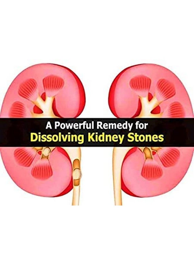 KEVA ASMARI (stone crush) 200ML (pack of 3) - Image 3