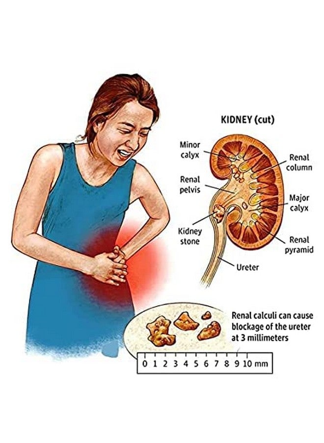 KEVA ASMARI (stone crush) 200ML (pack of 3) - Image 2