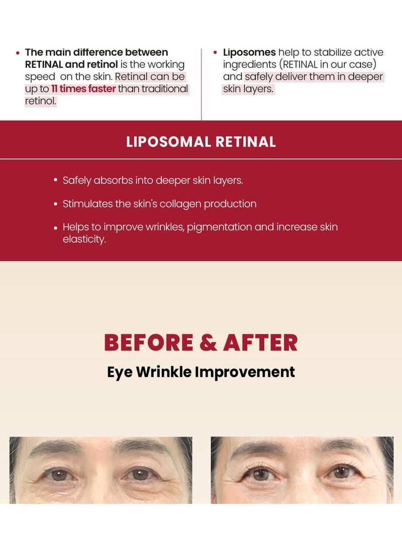 K-SECRET - SEOUL 1988 Eye Cream : Retinal Liposome 4% + Fermented Bean 30 ml - Image 1